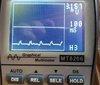 01_Oscilloscope of PWM from console.jpg